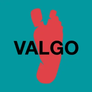 VALGO Хирургия стопы | Подология